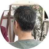 脊髄小脳変性症の鍼灸治療を受けている石川県 N.H. さん
