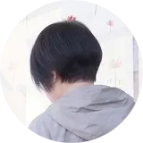 脊髄小脳変性症31型の鍼灸治療を受けている秋田県 Y.O. さん